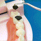 🔥✨【Kup 1 otrzymaj 1 za darmo】🦷Zestaw wykałaczek ze stali nierdzewnej